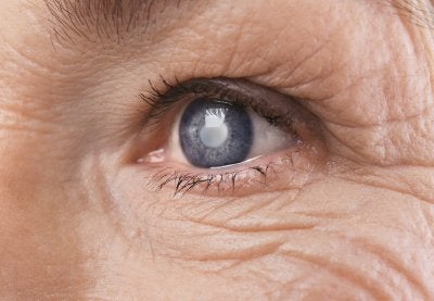 Glaucoma facts - Gerstein Eye Institute